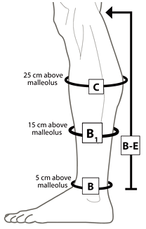 Circaid 28cm Standard Juxta-Fit Essentials Lower Legging, Large Full Calf